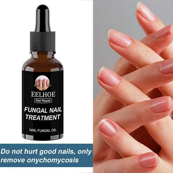 50ml EELHOE Nagelvårdslösning För Förtjockning Och Uppljusning Av Naglar Tar Bort Grå Och Döda A1X5 brownA 30ml