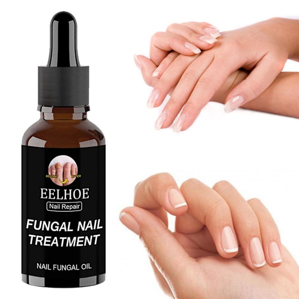 50ml EELHOE Nagelvårdslösning För Förtjockning Och Uppljusning Av Naglar Tar Bort Grå Och Döda A1X5 brownA 30ml