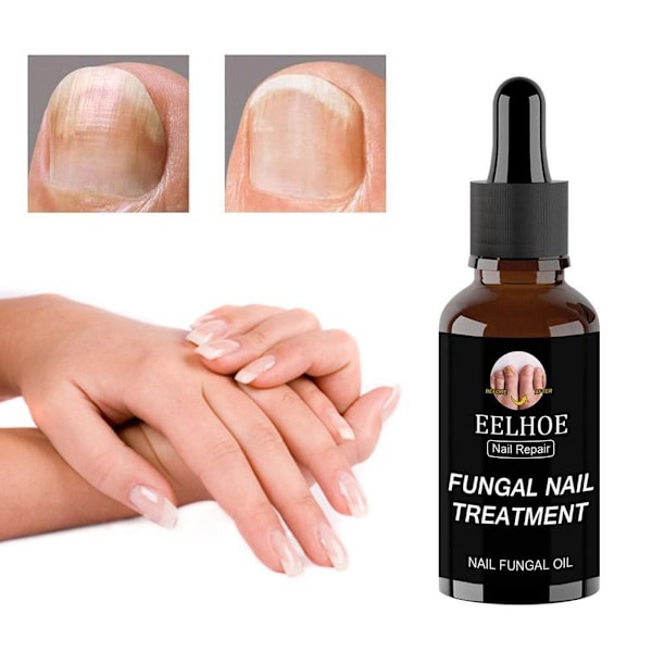 50ml EELHOE Nagelvårdslösning För Förtjockning Och Uppljusning Av Naglar Tar Bort Grå Och Döda A1X5 brownA 30ml