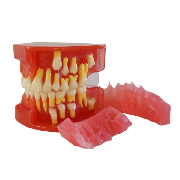Tandmodell med 28 löstagbara tänder Medicinskt läroverktyg Tänderrestaurering Behandling Demonstrationsmodell för studier