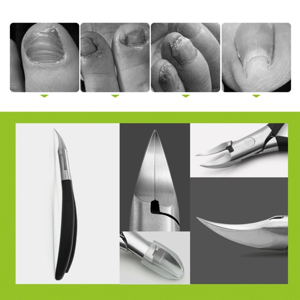 Tånagelklippare för tjocka naglar eller inåtväxande tånagelverktyg Set-Nagelklippersats med inåtväxta tånagellyftare för män kvinnor Black Single handle