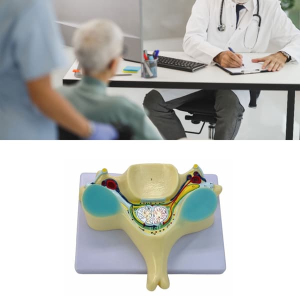 Rygmarvsoverdeling Model til Medicinstuderende Menneskelige Knoglemodel