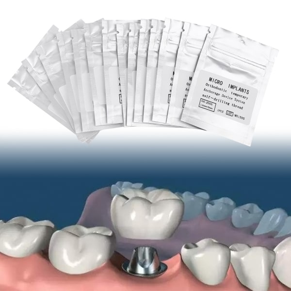 Dentala mikroimplantat Skruv självborrande tråd Ortodontisk förankring 1.6mm*8mm