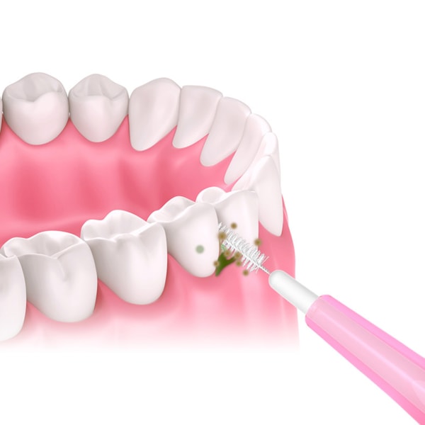 60st 0,6-1,5 mm mellanrumsborstar Hälsovård Tand Push-pull Tar bort mat och plack Bättre tänder Munhygienverktyg Pink