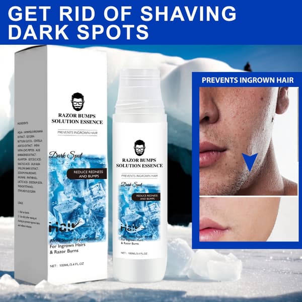 Behandlinger mod barberknopper efter barbering, vand mod indgroede hår til kroppen