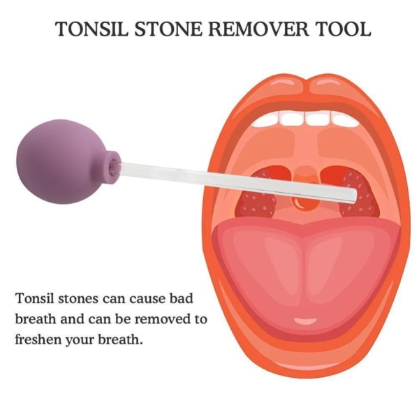 Tonsil Stone Removal Tool Munrengöring Vårdverktyg ROSE RED rose red