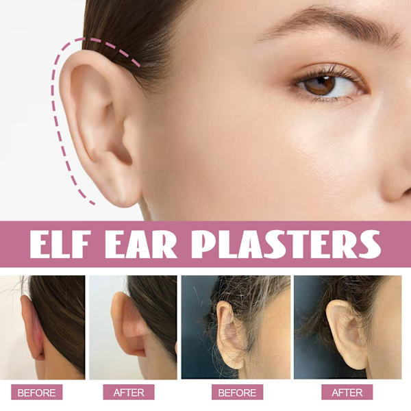 30st Ear Corrector Elf Ear Stickers Öronstöd