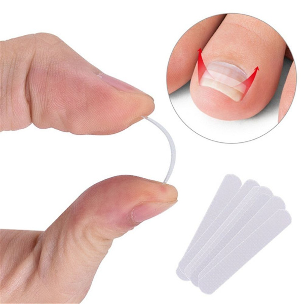 20st/flaska Nagelkorrigeringsverktyg Nail Groove Pad inväxt 20Pcs/Bottle