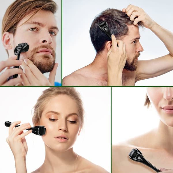 Derma Roller til hår, skæg, ansigt, hud, krop, hovedbund 540 mikronåle til mænd og kvinder, 0,5 mm Black
