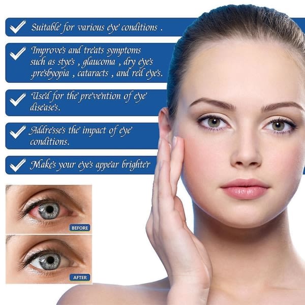 SQBB 30 ml Ömma ögondroppar lugnar och rengör mindre ögoninfektioner