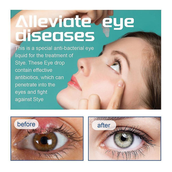 SQBB 30 ml Ömma ögondroppar lugnar och rengör mindre ögoninfektioner