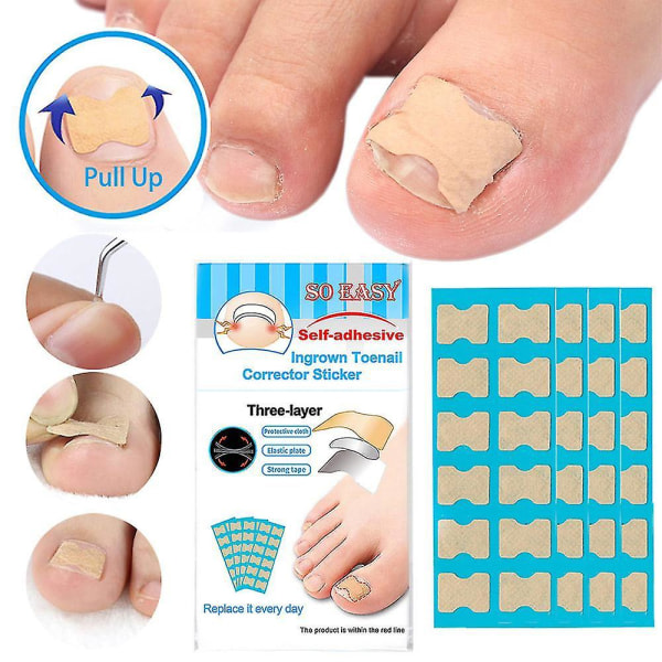 36st Limfri inåtväxande nagelpasta Inåtväxande nagelkorrigerare