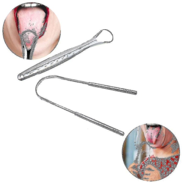 2pcs Stainless Steel Tongue Scraper Brush Cleaning Scraper Oral Care Tongue Cleaner Tools