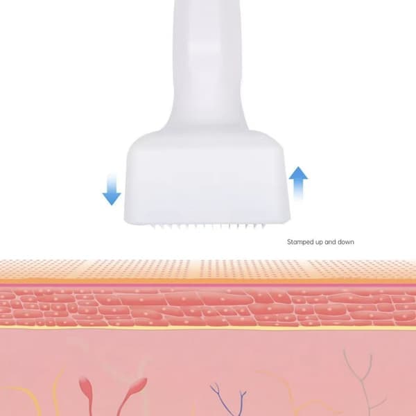 Justerbar Microneedling Derma Stamp - 140 Titanium Pin Professionel Microneedle [Ho]