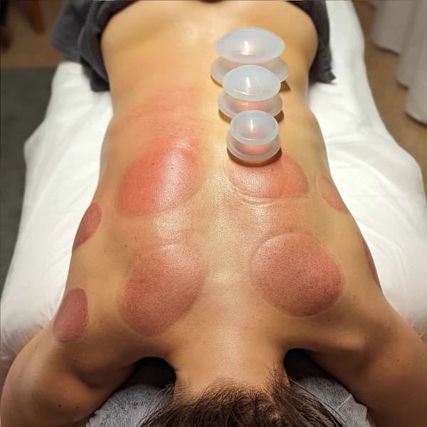 Cupping Set - Effective and Relaxing Massage Compatible with the Whole Body White White White,SE