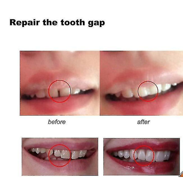 10g/100g Tooth And Space Denture Solid Glue Resin Denture Adhesive