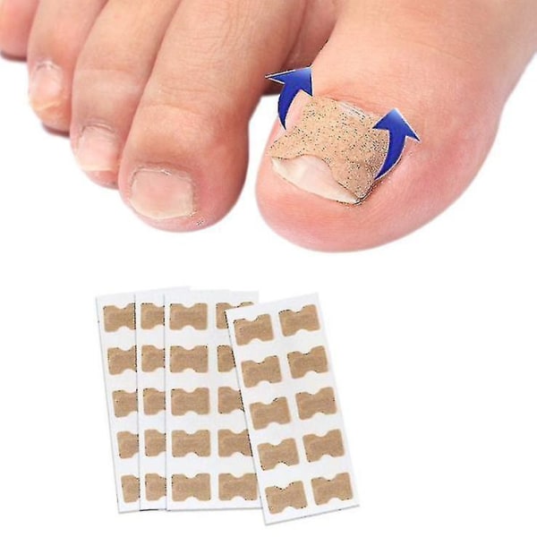 100pcs Toenail Correction Patch Glue Free Pedicure Tools Corrector Toe Nail Ingrown Patch
