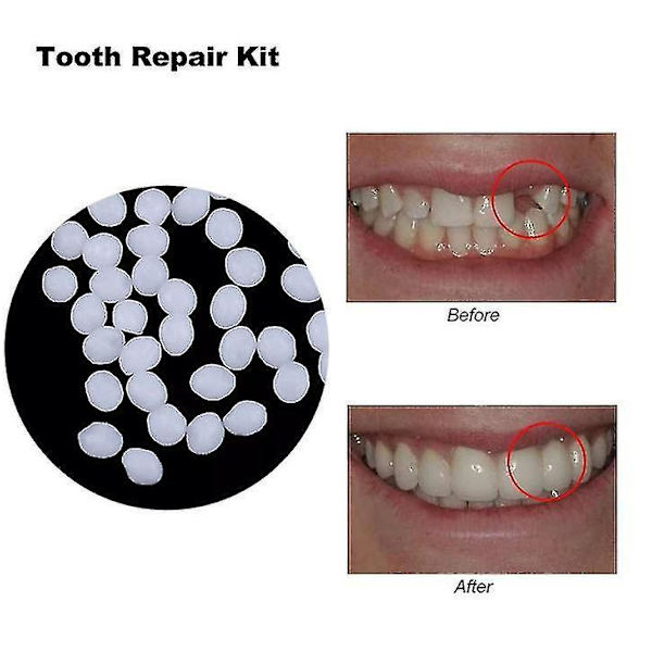 10g/100g Tooth And Space Denture Solid Glue Resin Denture Adhesive Dental Dentist Denture Solid