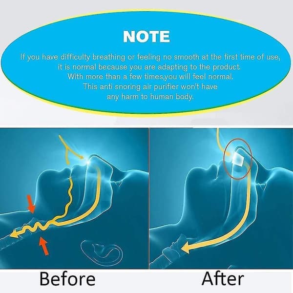 Electronic Anti Snoring Devices, Usb Rechargeable Oxygen Concentrator