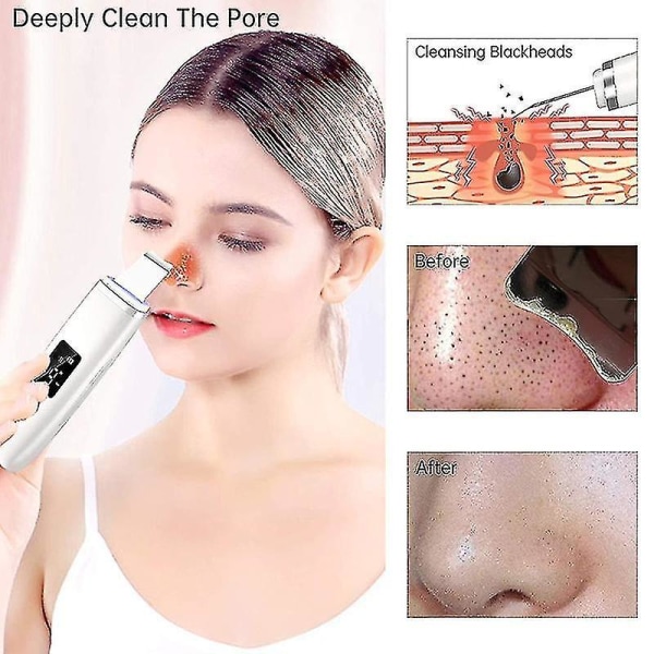 Lasta Blackhead Remover Pore Rengjøring Multifunksjonell Ansikts Comedone P