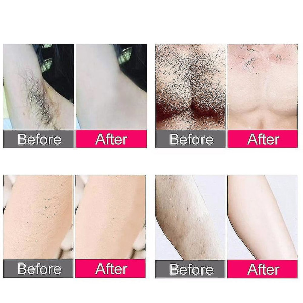 IPL Hårfjerning Laser Hårfjerningsenhet 300000 Blink Barbering og Hårfjerning, Permanent Hårfjerningsenhet Kvinner Smertefri Lys Hår pink