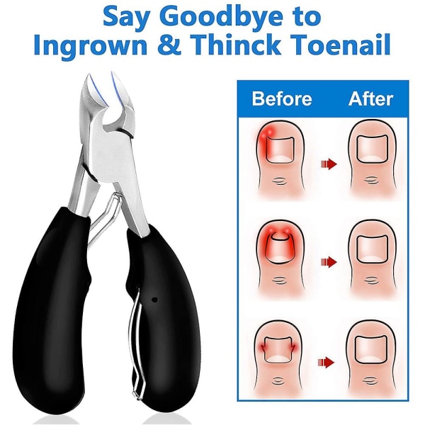 Fodterapeut tånegleklipper Tykk & indgroet tå negleklipper