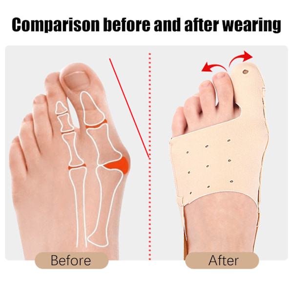 Bunion Corrector för Hallux Valgus, Justerbar Tåriktare M