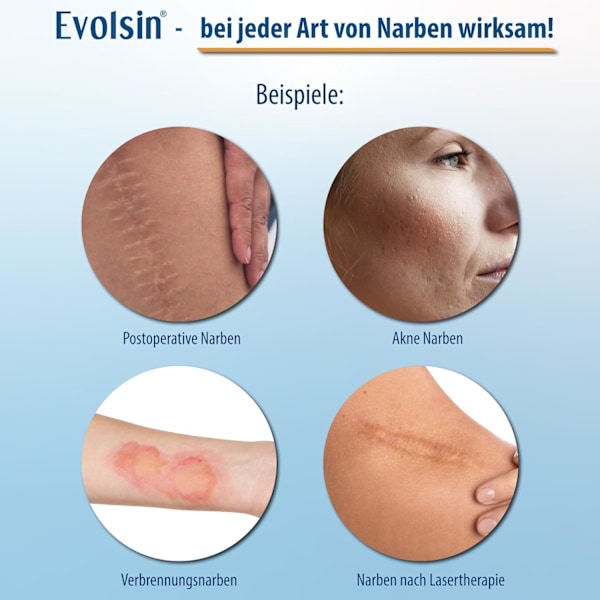 Ärrtejp - Silikonärrark Matt transparent färg 1 m