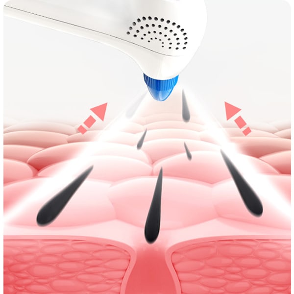 Whitehead Remover - White - Pore Vacuum Cleaner