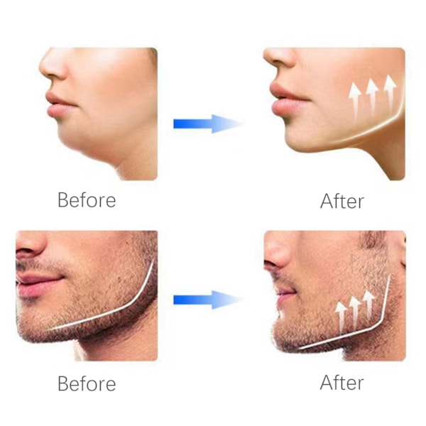 Käktränare Jawline exerciser 2-pack Svart