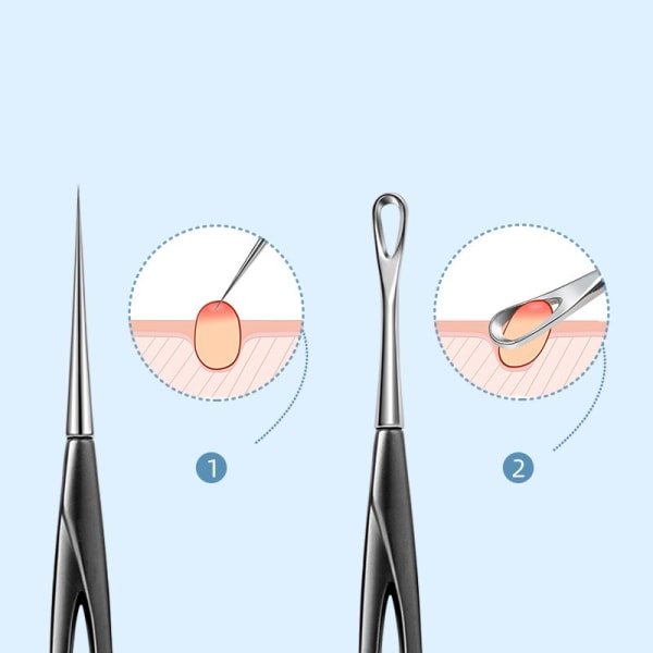 2 Pack Blackhead Remover Tools Pimple Removal Tools Akne Neulat Hopea