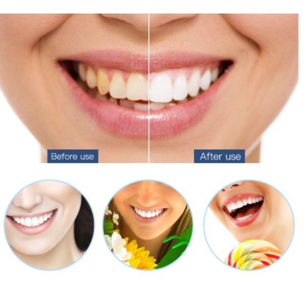 Tandstensfjerner med 5 positioner genopladelig Sort