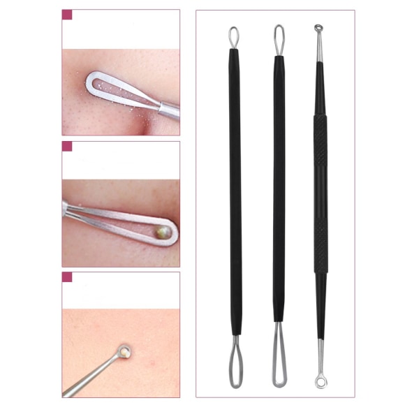 5-pack Blackhead Remover Acne Needle Tools Kit Svart