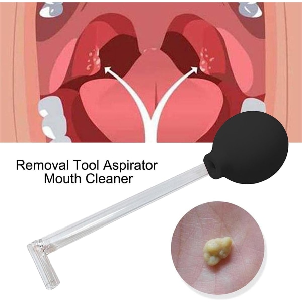 INF Borttagningsverktyg för tonsillstenar Svart