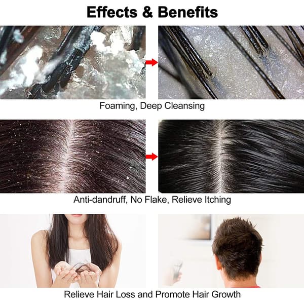 Børste til hovedbundsmassage og peeling Black Black