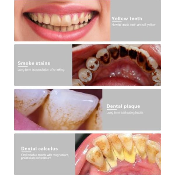 INF Ultraljud tandstensborttagare och 4 rengöringshuvuden Svart