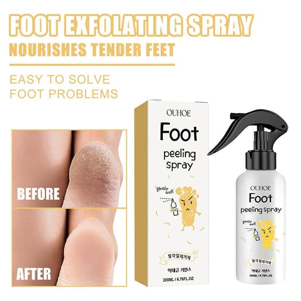 1-6pcs EELHOE Foot Peeling Spray 200ml Instant Moisturizing Gentle Foot Peeling Spray for D Removal (1pc)