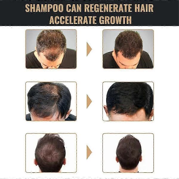 2 STK Spartan Shampoo, Spartan Root Activator Shampoo, Mane Root Activator Shampoo