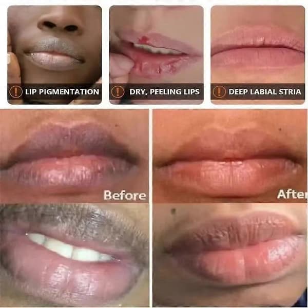Lip Balm for Smokers Dark Lip Treatment with Pigment Equalization and Deep Hydration