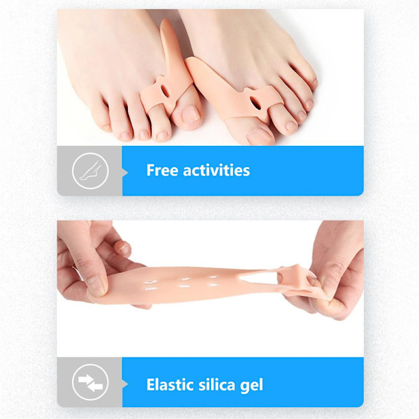 2 Par Tåseparatorer Tåavstånd Bunionkorrigerare Silikon Ortos Bunion Relief för Bunion Överlappning