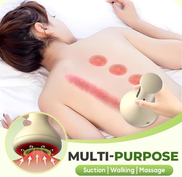 Håndholdt Cellulitmassager Cellulitfjerner til Ben Cellulitmaskine Håndholdt Massager til Mave Lår Balder (Beige)