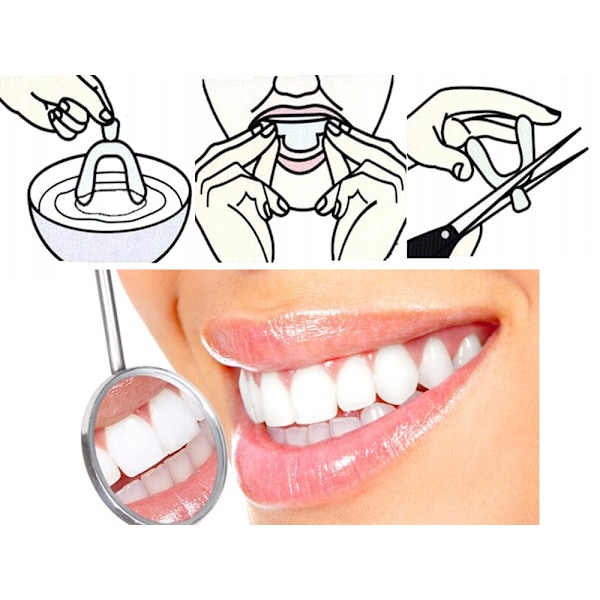 Två transparenta bettskenor – för bruxism och blekning med perfekt passform
