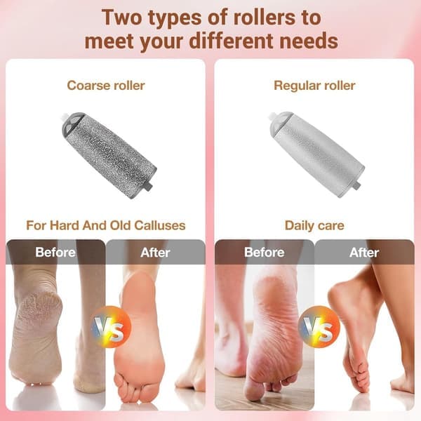 Electric Foot File for Calluses comes with Rollers, a USB Charging Cable, and an Extra Light for Callus Removal and Daily Use