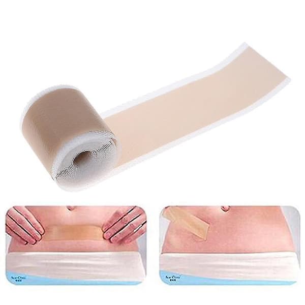 Ny silikongel arrfjerningsark terapi patch for akne traume brannskade hud, 4cm*1.5m