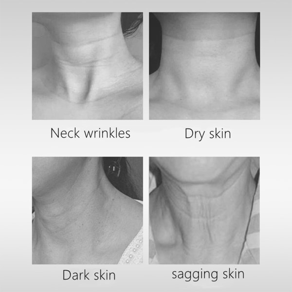 Neck Beauty Device Removal Double Menton Facial Lifting