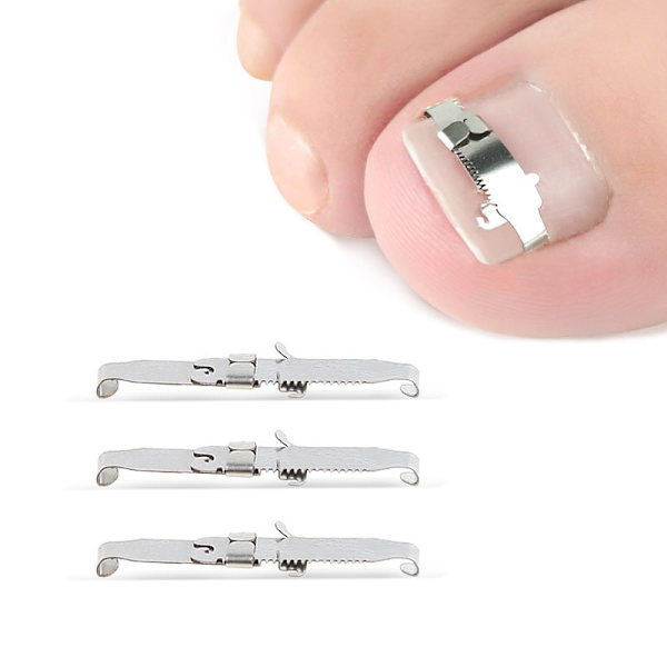 Nagelspänne, storlek 42, nagelspårsanordning, dragbäddad spik,