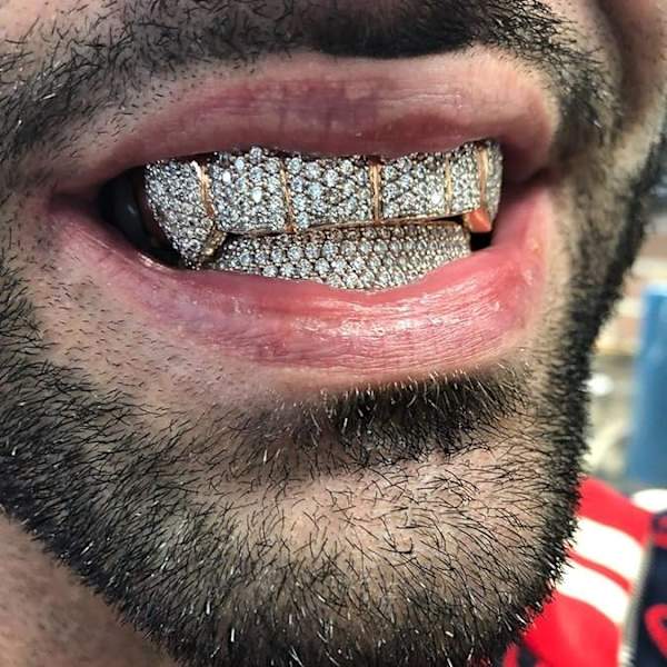 Diamanter Grills för Dina Tänder Kvinnor 18K Guldförgylld Fullt Isad Ut