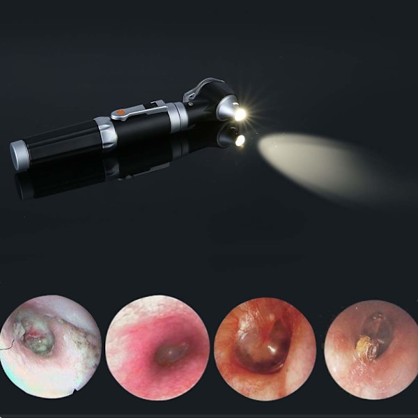 Mini øre-otoskop, forstørrelsesdiagnostisk øreskopinspeksjon