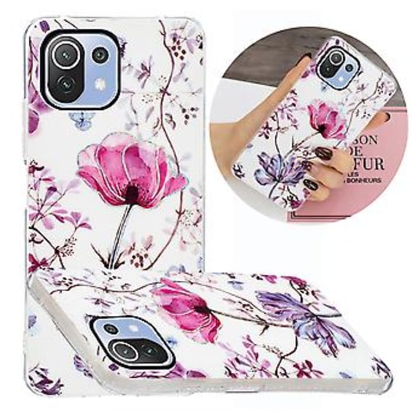 PC + TPU-deksel for Xiaomi Mi 11 Lite 5G Silver