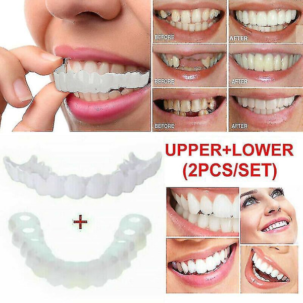 Snap On falske tænder Øvre + Nedre Dental Finer Protes Tand Cover Set A Only Upper teeth